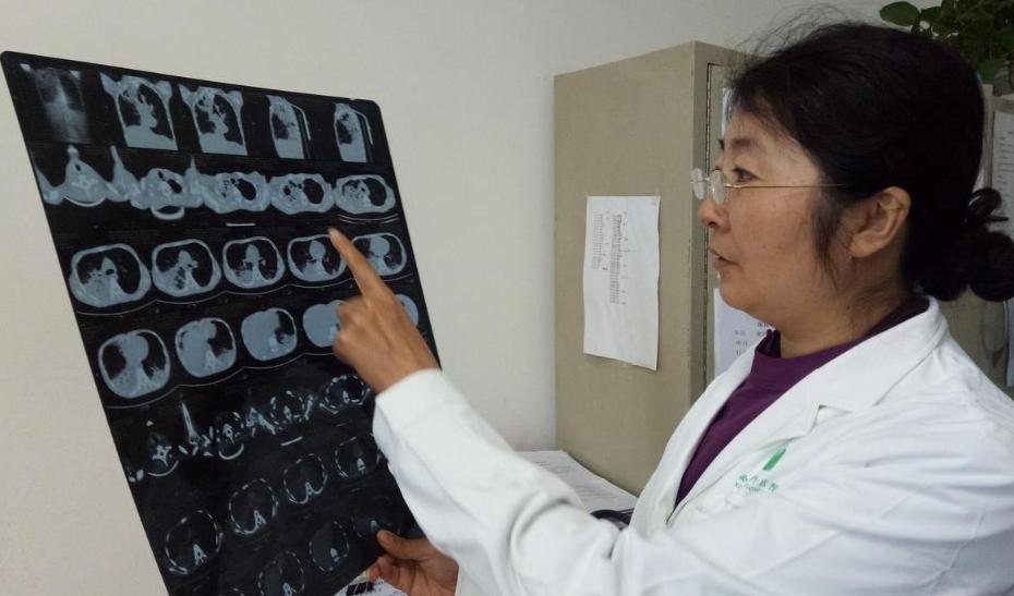 男子退燒第二天返崗 就醫時接近白肺