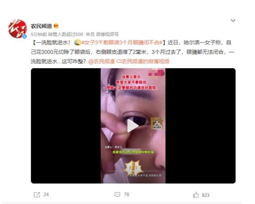 眼袋手術后3個月眼睛閉不合，女子苦惱洗臉進水該如何解決？