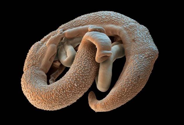 南京疾控發布預防血吸蟲病的提示，市民應加強防控