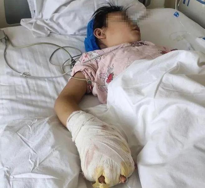 甘肅女童遭繼母虐待致殘，父親堅決追究，警方已介入調查